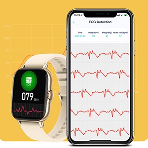 offerta smartwatch monitoraggio salute ECG